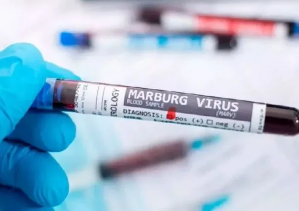 Virus de Marburgo: Alertas y Medidas en Salud Pública